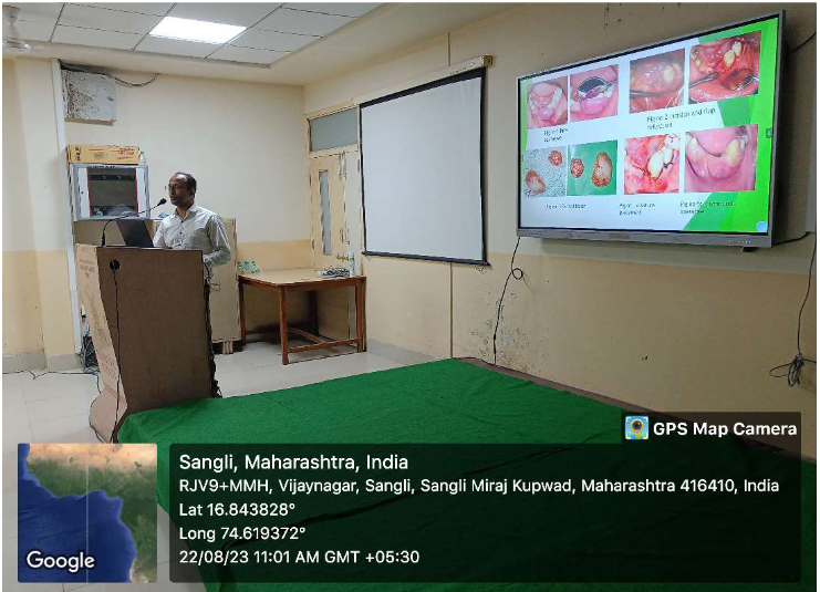 “Recurrent lobular capillary hamengioma and its management”